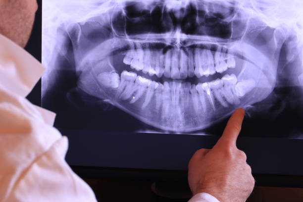 Best Dental Abscess Treatment in Elkhorn City, KY